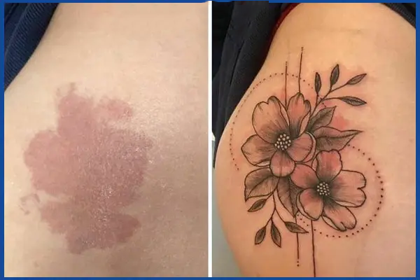 Scar Cover-up Tattooing