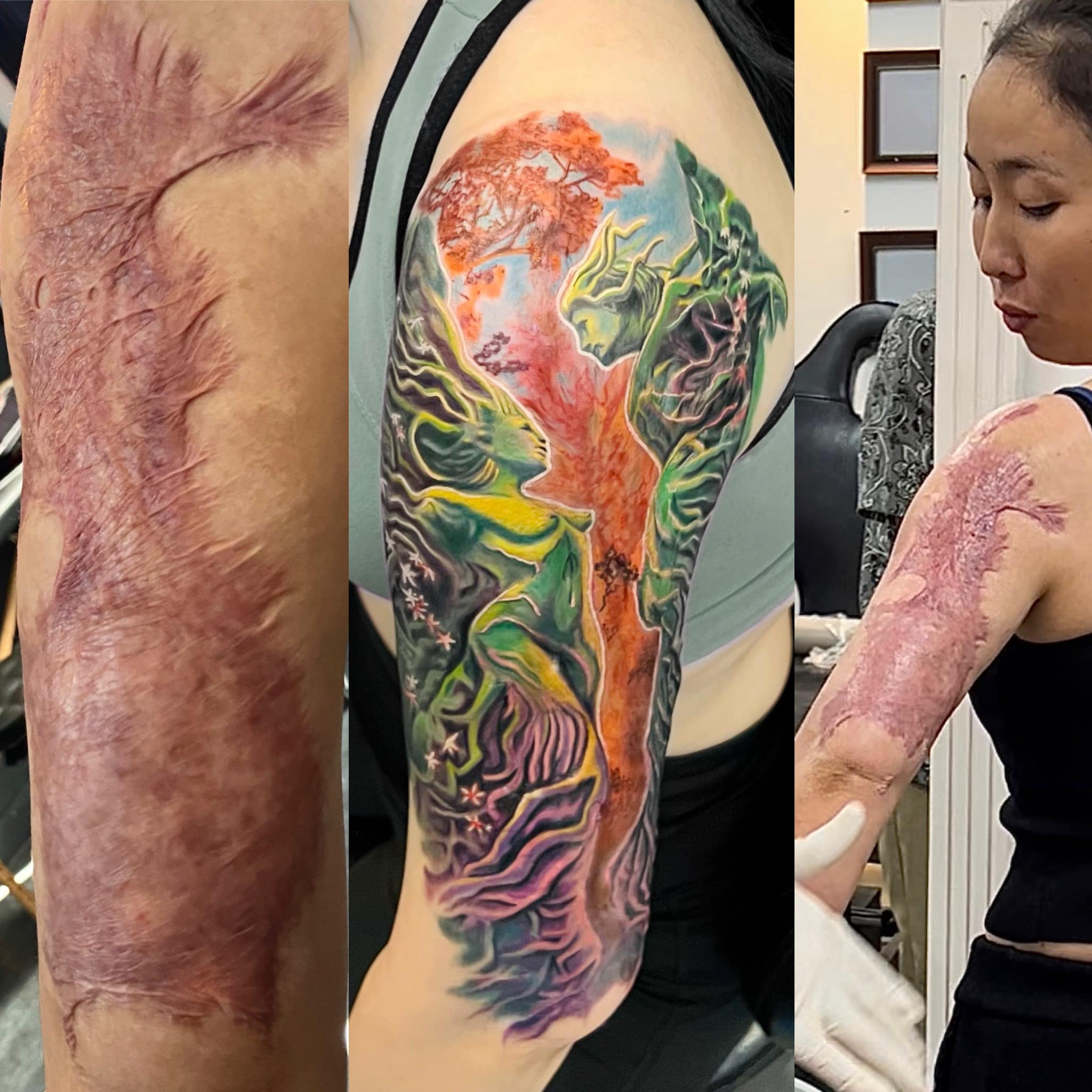 Reasons to choose Viet Ink Tattoo for professional scar cover-up tattoos: