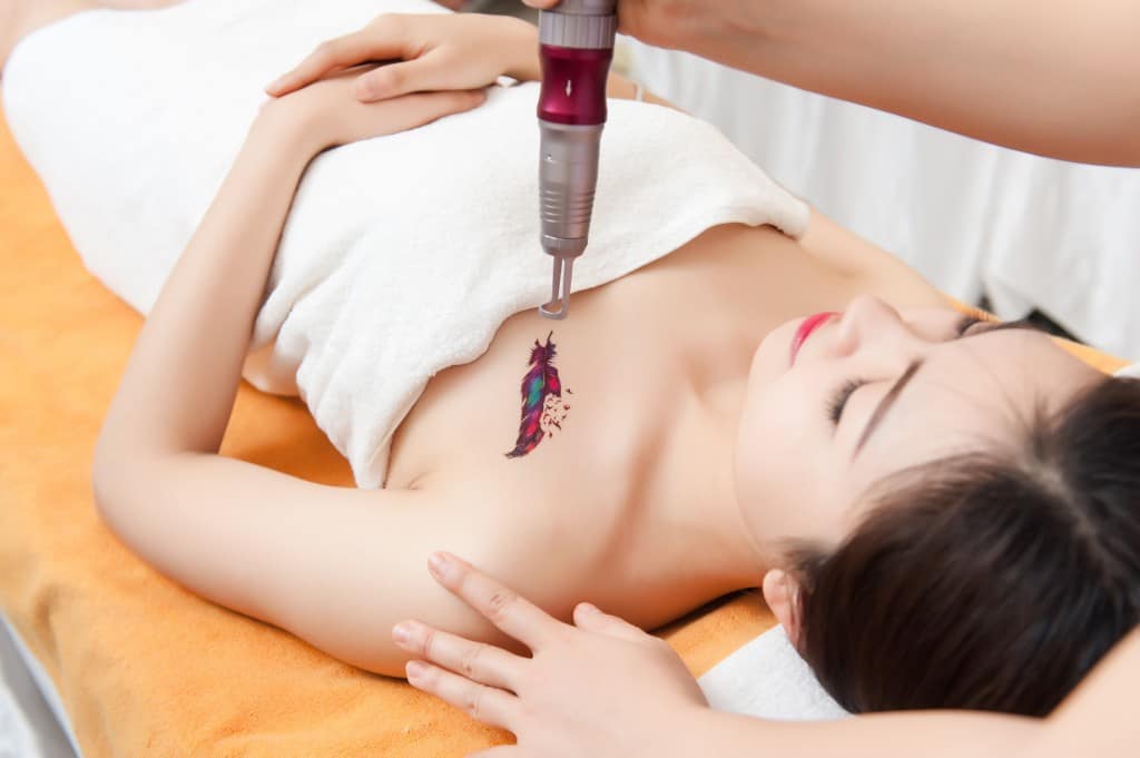 Current Painless Tattoo Removal Technologies – Popular Methods