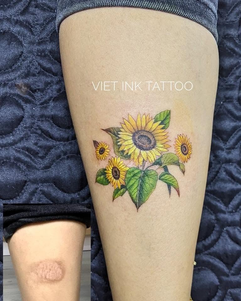 Match Your Tattoo Design to the Scar’s Texture
