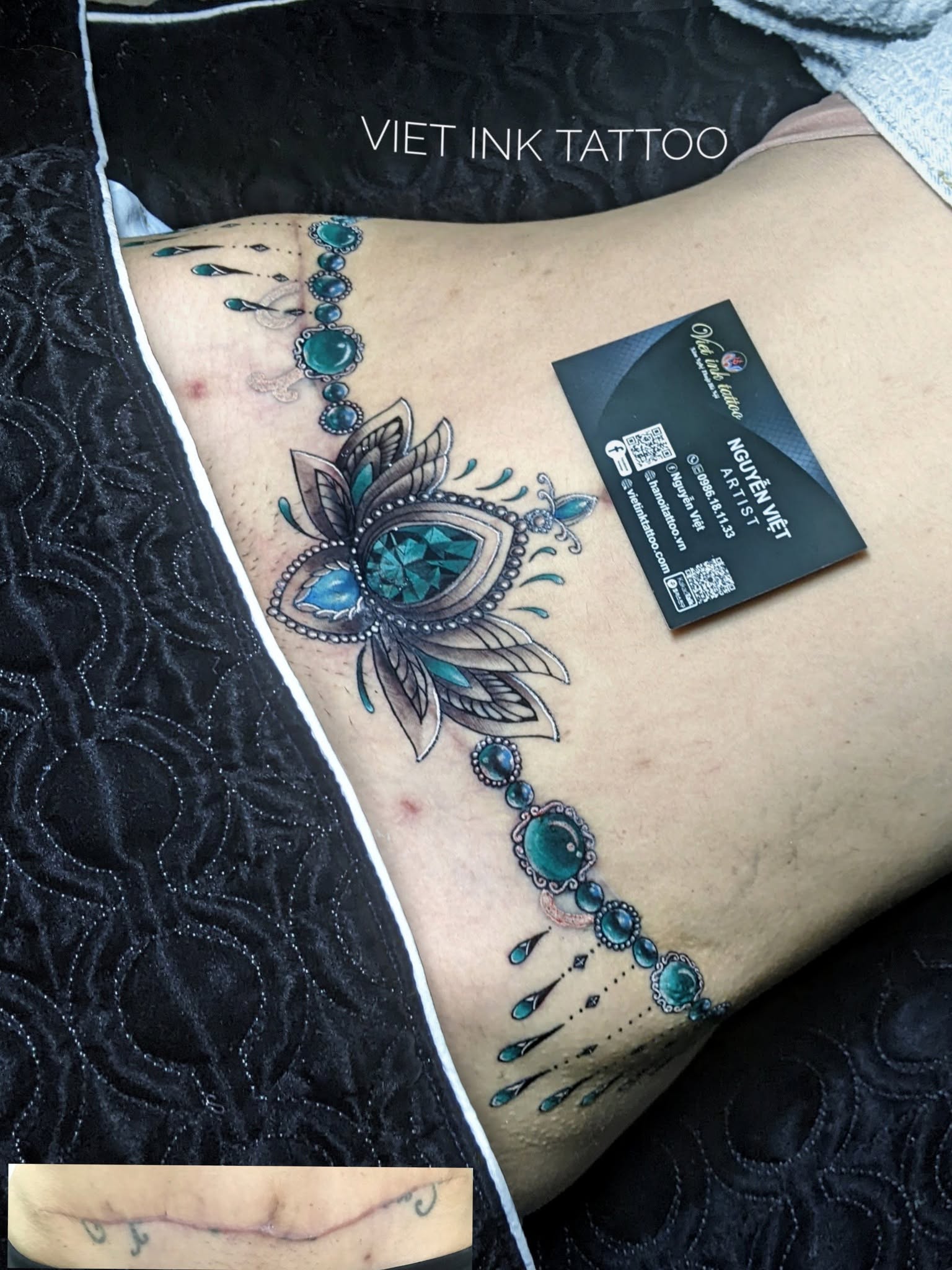 Looking for a Scar Tattoo Artist? Discover Expert Care at Viet Ink Tattoo 3 Discover Professional Scar Cover-Up Tattoo Services at Viet Ink Tattoo