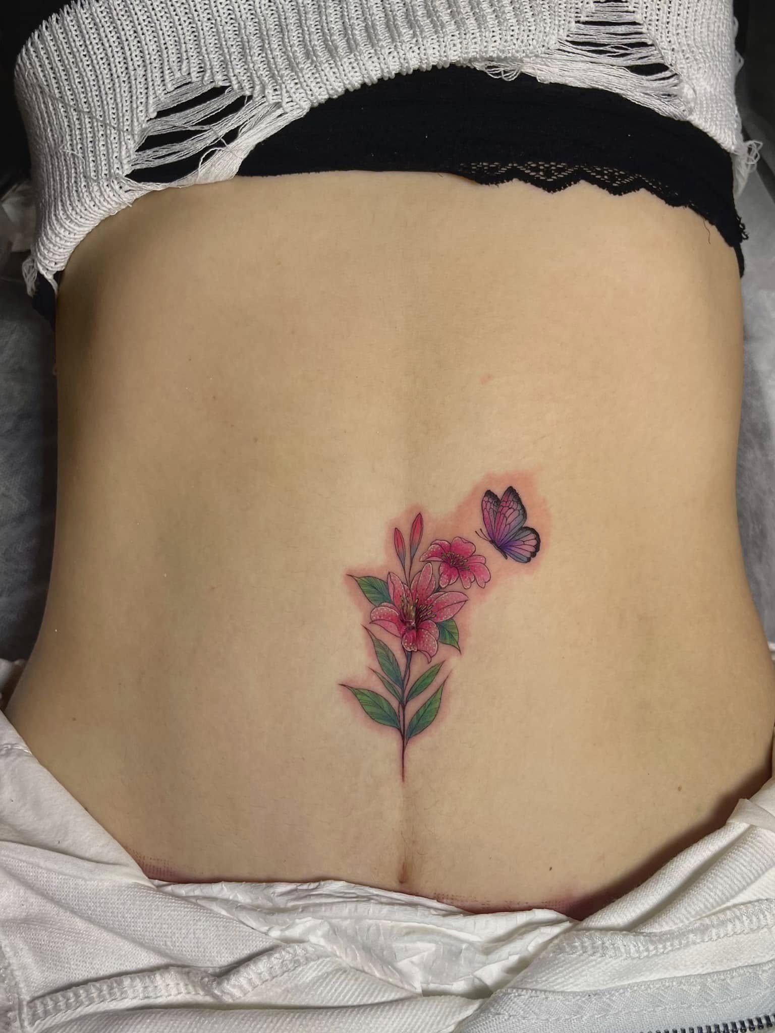 Top 20+ Stunning Scar Cover Tattoo for Women Ideas to Inspire You in 2026 8 Top 20+ Stunning Scar Cover Tattoo for Women Ideas to Inspire You in 2026