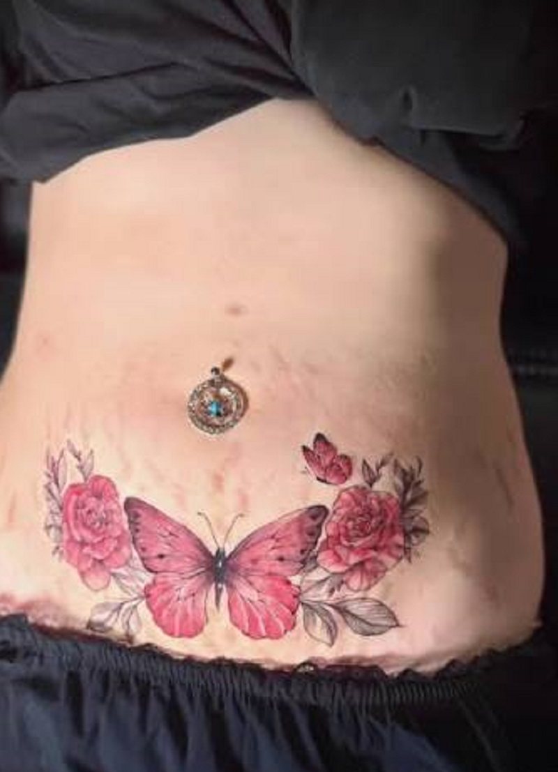 Best Design Ideas for a Stretch Mark Cover-Up Tattoo 4 Best Stretch Mark Cover-Up Tattoo Design Ideas