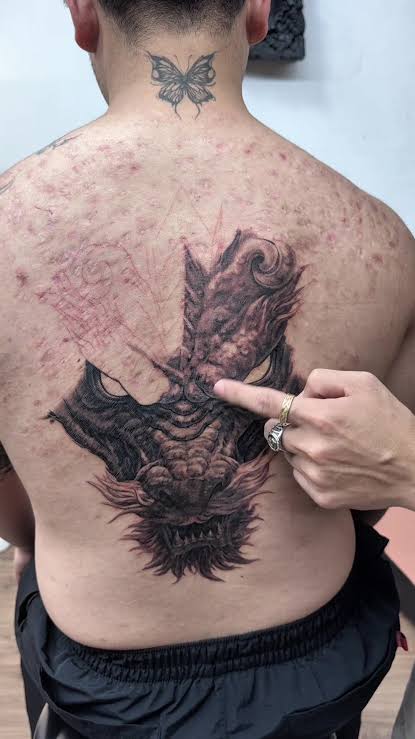 Acne Scar Cover-Up Tattoo: Design Ideas and Helpful Tips 2 Can You Tattoo Over Acne Scars?